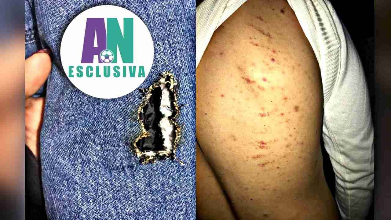 aggressione di Salerno ad Emiliana